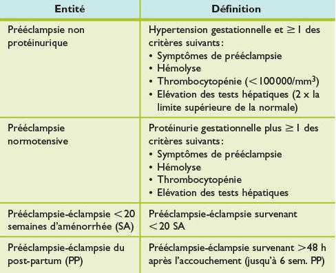 tableau